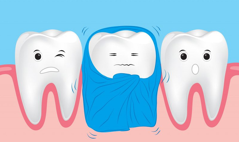 Răng nhạy cảm minh họa